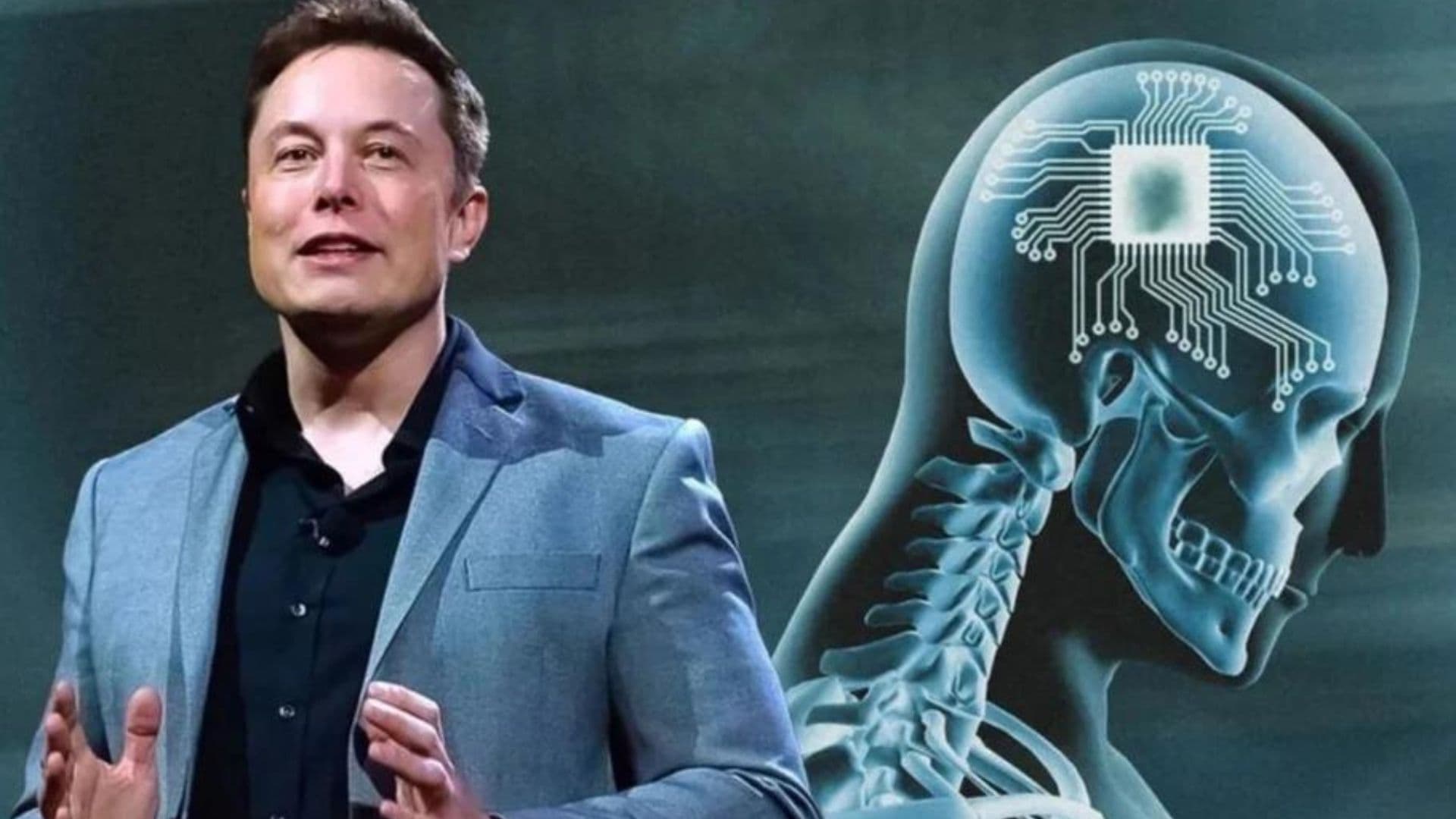 Neuralink testará Chips Cerebrais em Humanos