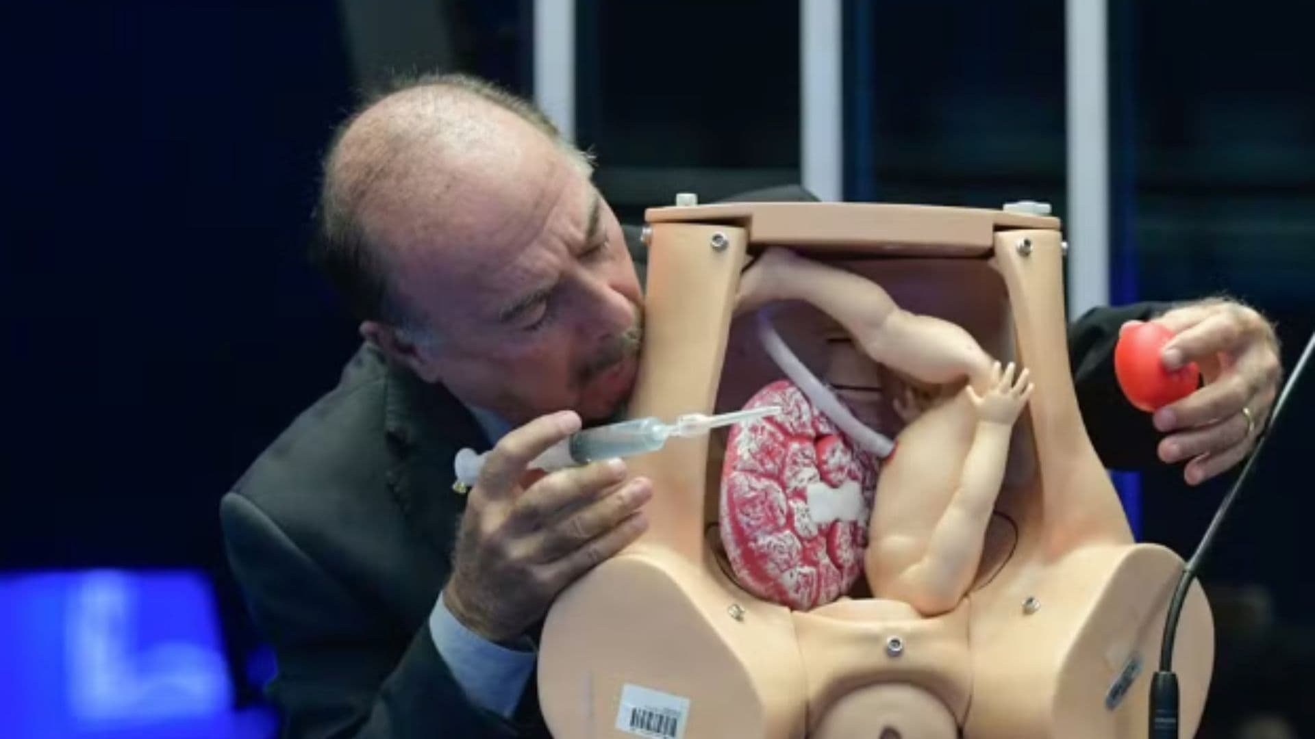 O presidente do CFM demonstra como é feito o aborto por assistolia fetal