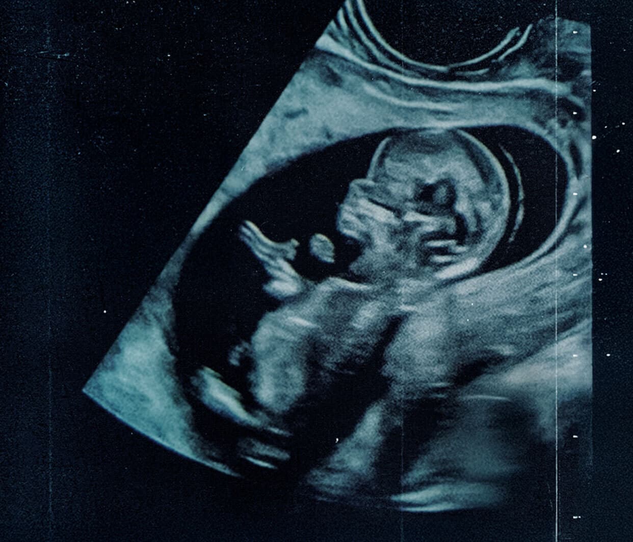 Duas vidas - Do que Estamos Falando quando Falamos de Aborto